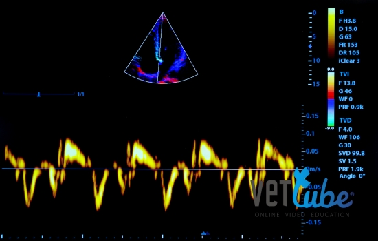 Echocardiografie: Doppler onderzoek