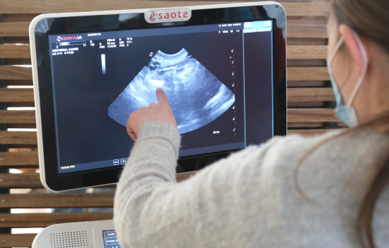 Perfectionnement en &eacute;chographie abdominale - Edition 5